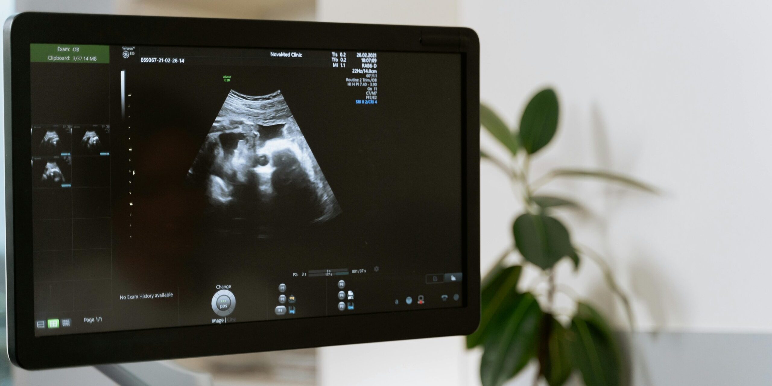 Prokuratura umorzyła sprawę polskiej lekarki, która dokonała aborcji w dziewiątym miesiącu ciąży